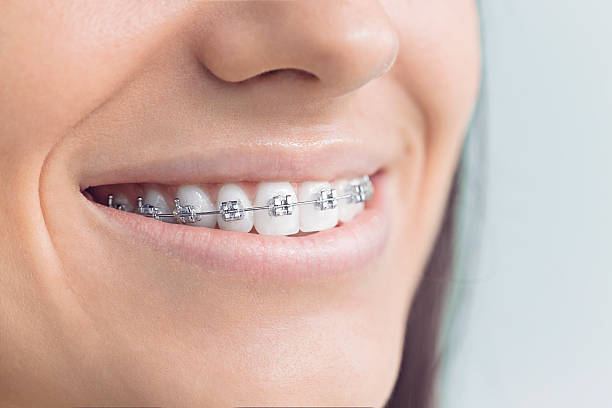 Dental Bonding in Pembroke Park, FL